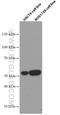 Sterile Alpha Motif Domain Containing 3 antibody, 66599-1-Ig, Proteintech Group, Western Blot image 