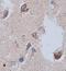 Ciliary neurotrophic factor receptor subunit alpha antibody, orb76973, Biorbyt, Immunohistochemistry paraffin image 