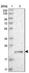 Gamma-Glutamylcyclotransferase antibody, NBP1-86727, Novus Biologicals, Western Blot image 