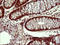 Uracil Phosphoribosyltransferase Homolog antibody, LS-C788339, Lifespan Biosciences, Immunohistochemistry paraffin image 
