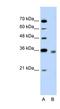 2,4-Dienoyl-CoA Reductase 2 antibody, NBP1-53172, Novus Biologicals, Western Blot image 
