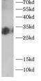 Collagen Triple Helix Repeat Containing 1 antibody, FNab10468, FineTest, Western Blot image 