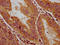 HLCS antibody, LS-C680605, Lifespan Biosciences, Immunohistochemistry paraffin image 