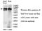 Zinc Finger Protein 546 antibody, MBS416090, MyBioSource, Western Blot image 