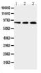Toll Like Receptor 2 antibody, PA2247, Boster Biological Technology, Western Blot image 