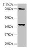 NADH:Ubiquinone Oxidoreductase Subunit S5 antibody, LS-B10636, Lifespan Biosciences, Western Blot image 