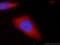 Ubiquitination Factor E4B antibody, 18148-1-AP, Proteintech Group, Immunofluorescence image 