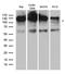 Cbl Proto-Oncogene antibody, TA890105S, Origene, Western Blot image 