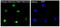 Mitogen-Activated Protein Kinase 8 antibody, MP02608, Boster Biological Technology, Western Blot image 