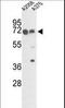 Peptidyl-prolyl cis-trans isomerase FKBP10 antibody, LS-B13750, Lifespan Biosciences, Western Blot image 