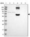 Beta-Ala-His dipeptidase antibody, NBP1-85528, Novus Biologicals, Western Blot image 