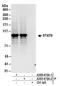 Signal Transducer And Activator Of Transcription 6 antibody, A300-415A, Bethyl Labs, Immunoprecipitation image 