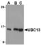 Ubiquitin Conjugating Enzyme E2 N antibody, TA306183, Origene, Western Blot image 