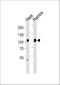 Sp1 Transcription Factor antibody, M00110-1, Boster Biological Technology, Western Blot image 