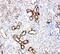 Solute Carrier Family 2 Member 5 antibody, PA5-80024, Invitrogen Antibodies, Immunohistochemistry paraffin image 