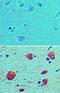 Bone Marrow Stromal Cell Antigen 1 antibody, PA5-23388, Invitrogen Antibodies, Immunohistochemistry paraffin image 