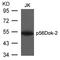 DOK2 antibody, A07956-2, Boster Biological Technology, Western Blot image 