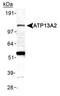 Probable cation-transporting ATPase 13A2 antibody, PA1-16975, Invitrogen Antibodies, Western Blot image 