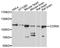 CORIN antibody, A10404, ABclonal Technology, Western Blot image 