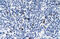 5-Hydroxytryptamine Receptor 3B antibody, ARP35186_P050, Aviva Systems Biology, Immunohistochemistry paraffin image 