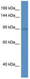 Solute Carrier Family 9 Member A5 antibody, TA333969, Origene, Western Blot image 
