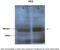 HK II antibody, ARP54303_P050, Aviva Systems Biology, Western Blot image 