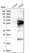 RNA Binding Motif Protein 23 antibody, NBP1-83857, Novus Biologicals, Western Blot image 