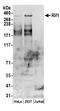Replication Timing Regulatory Factor 1 antibody, A300-569A, Bethyl Labs, Western Blot image 