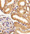 Fms Related Tyrosine Kinase 4 antibody, M01276-1, Boster Biological Technology, Immunohistochemistry paraffin image 
