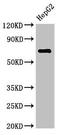 ST6 N-Acetylgalactosaminide Alpha-2,6-Sialyltransferase 1 antibody, orb53807, Biorbyt, Western Blot image 