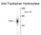 Tryptophan Hydroxylase 1 antibody, GTX82575, GeneTex, Western Blot image 