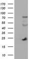 Joining Chain Of Multimeric IgA And IgM antibody, TA504175S, Origene, Western Blot image 