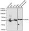 Serine/threonine-protein kinase OSR1 antibody, GTX66335, GeneTex, Western Blot image 