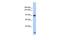 Upregulator Of Cell Proliferation antibody, GTX45073, GeneTex, Western Blot image 