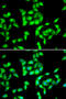 ANTXR Cell Adhesion Molecule 1 antibody, STJ28608, St John