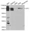 UPF1 RNA Helicase And ATPase antibody, abx001282, Abbexa, Western Blot image 