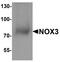 NADPH Oxidase 3 antibody, PA5-38036, Invitrogen Antibodies, Western Blot image 