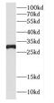 VSP antibody, FNab01308, FineTest, Western Blot image 