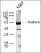 Perforin 1 antibody, orb312827, Biorbyt, Western Blot image 