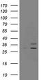 Succinate Dehydrogenase Complex Iron Sulfur Subunit B antibody, LS-C791480, Lifespan Biosciences, Western Blot image 