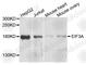 Eukaryotic Translation Initiation Factor 3 Subunit A antibody, A0573, ABclonal Technology, Western Blot image 