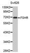 Follicle Stimulating Hormone Receptor antibody, LS-C332397, Lifespan Biosciences, Western Blot image 
