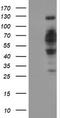 DNA Cross-Link Repair 1B antibody, TA502352, Origene, Western Blot image 