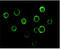 Bruton Tyrosine Kinase antibody, M00245-1, Boster Biological Technology, Western Blot image 