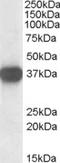 Nucleophosmin 1 antibody, TA303008, Origene, Western Blot image 