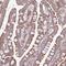 Armadillo Repeat Containing X-Linked 6 antibody, PA5-61659, Invitrogen Antibodies, Immunohistochemistry paraffin image 