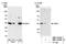 Survival Of Motor Neuron 2, Centromeric antibody, NBP1-03326, Novus Biologicals, Western Blot image 
