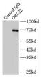 Origin Recognition Complex Subunit 2 antibody, FNab06006, FineTest, Immunoprecipitation image 