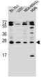 Endothelin-1 antibody, AP51365PU-N, Origene, Western Blot image 