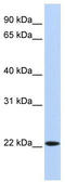 SSX Family Member 5 antibody, TA345317, Origene, Western Blot image 